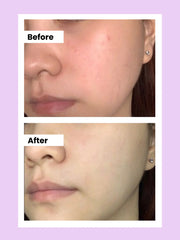 BRIGHTENING CREAM FOR ALL SKIN | 50g